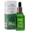 Rivaj Acne Face Serum 30ml